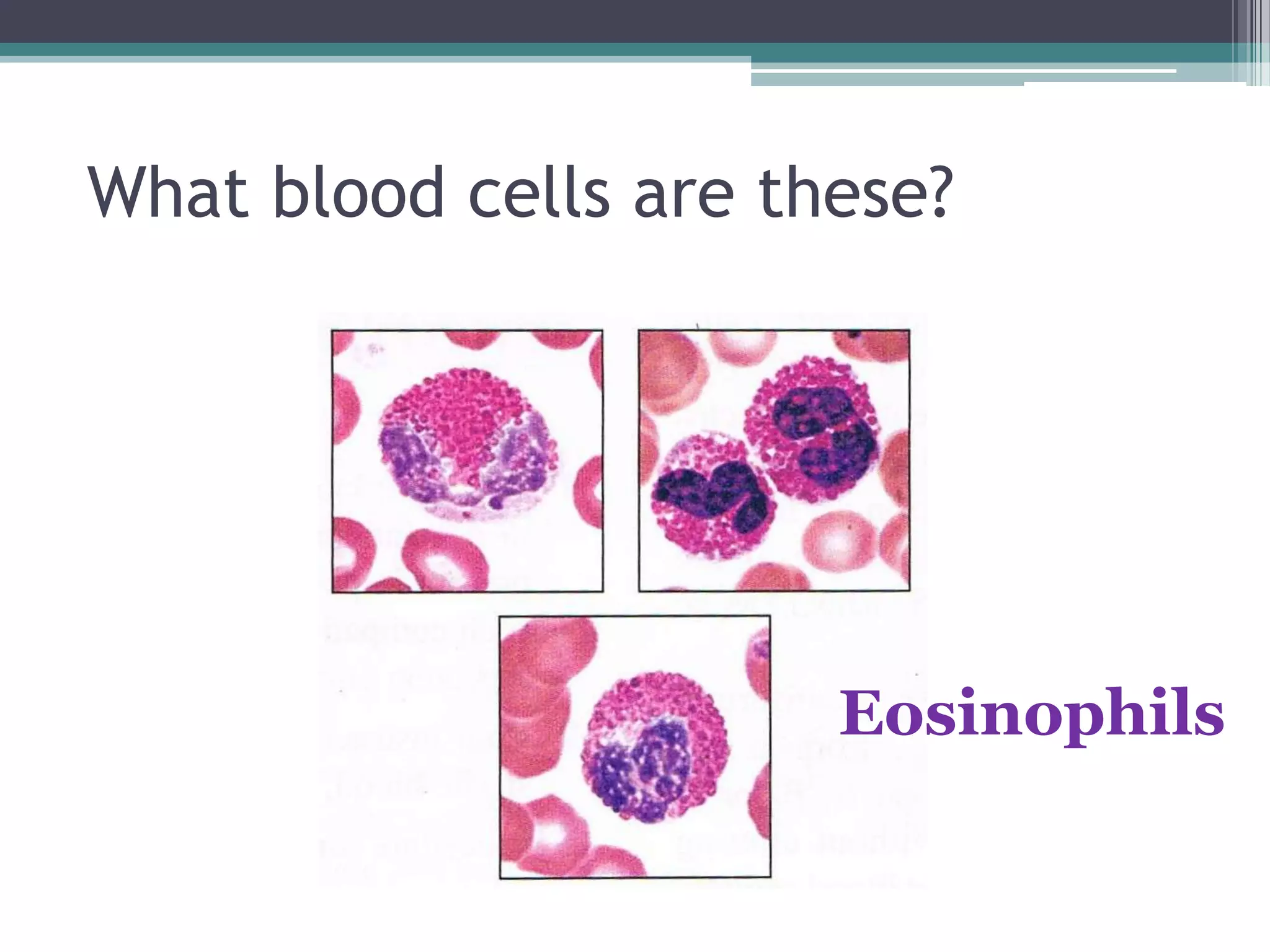 What blood cells are these?Eosinophils