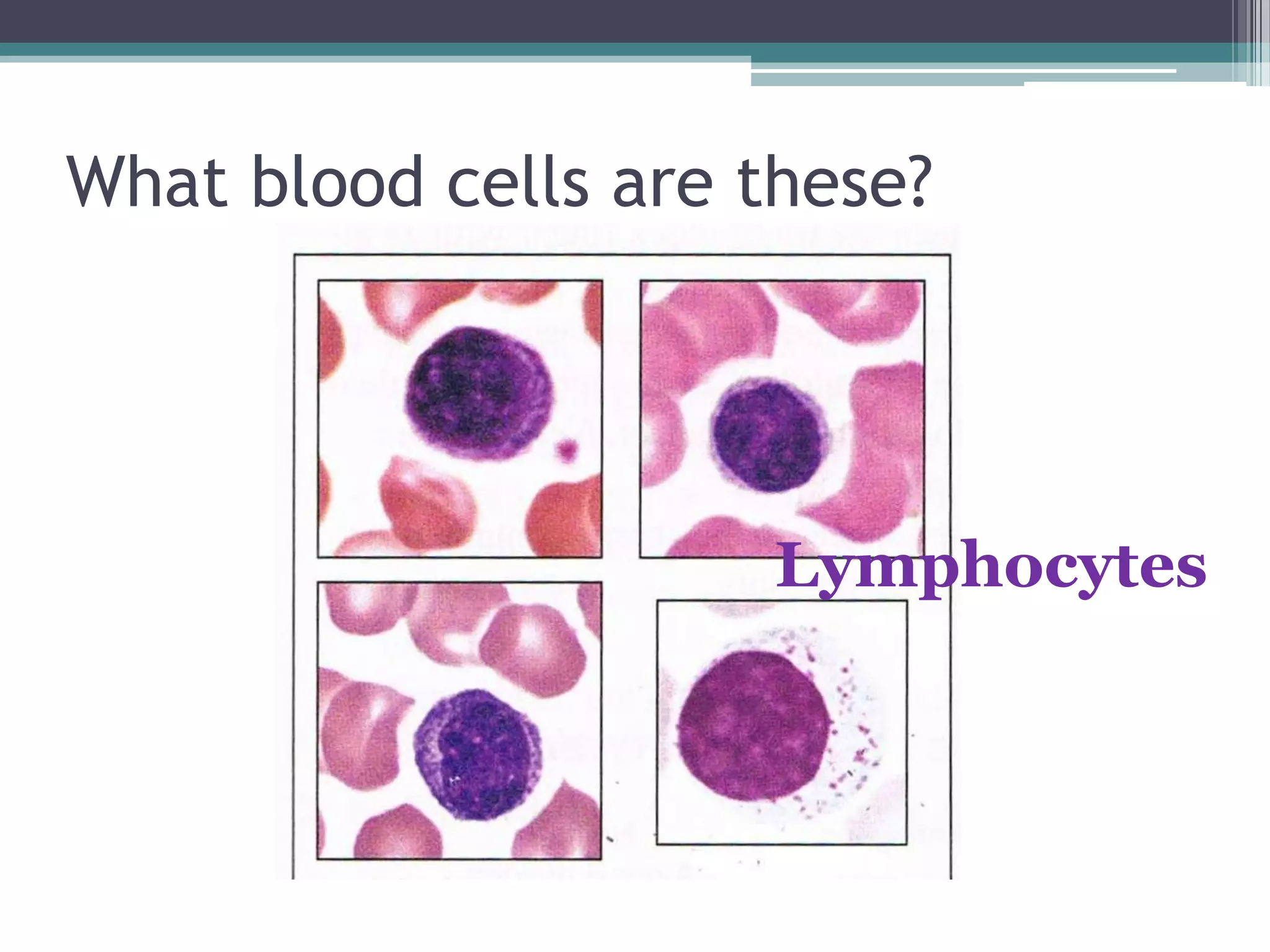 What blood cells are these?Lymphocytes