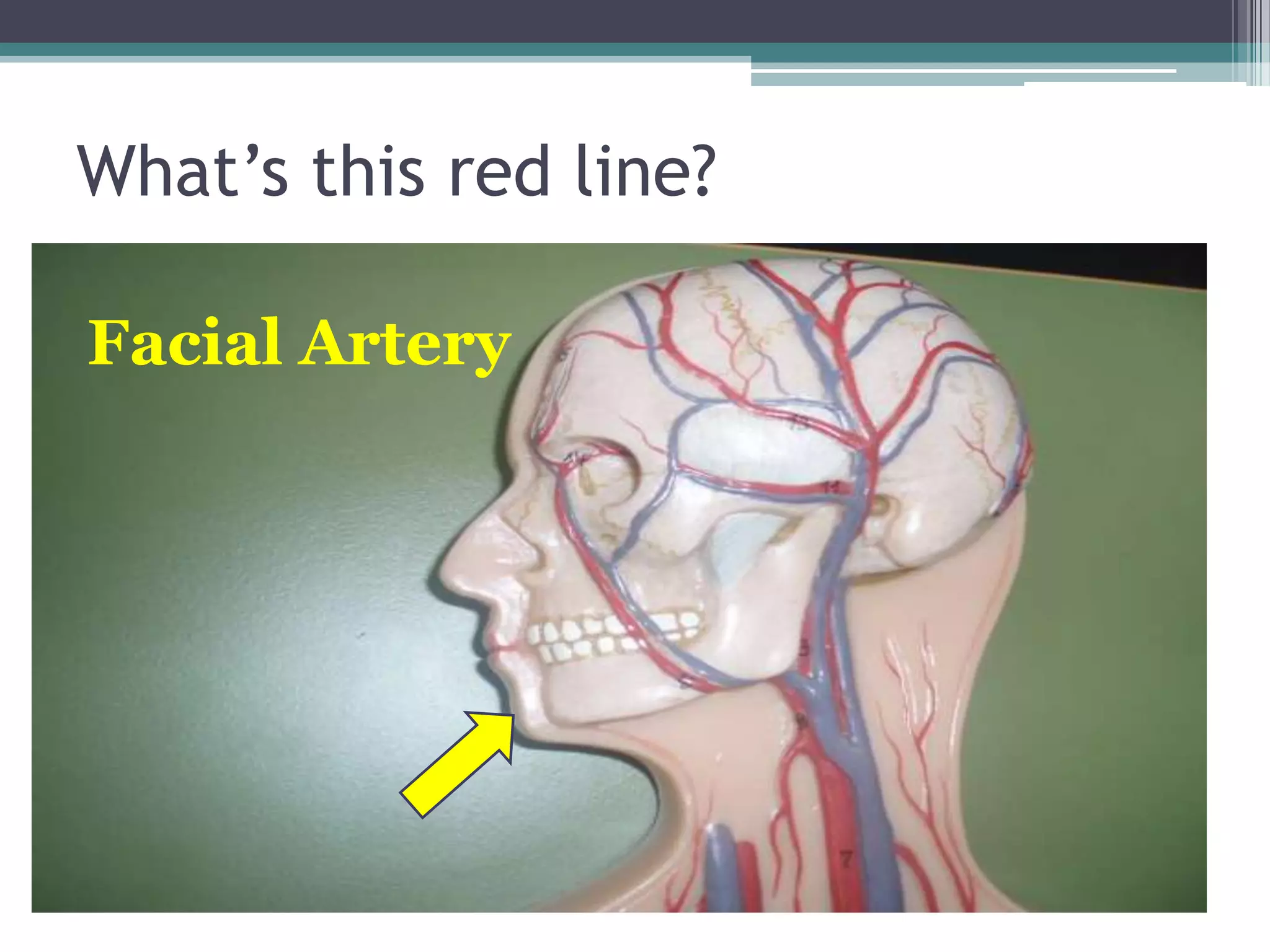 What’s this red line?Facial Artery