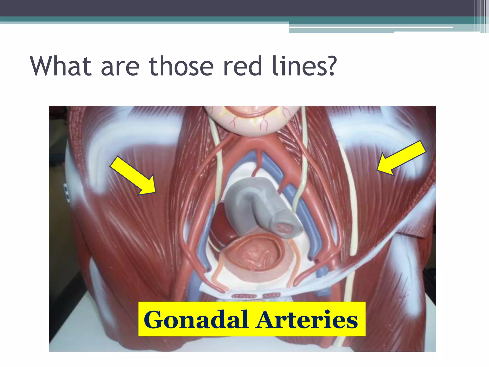What are those red lines?Gonadal Arteries