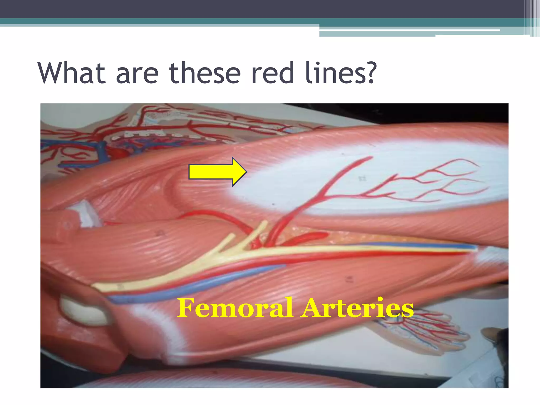 What are these red lines?Femoral Arteries