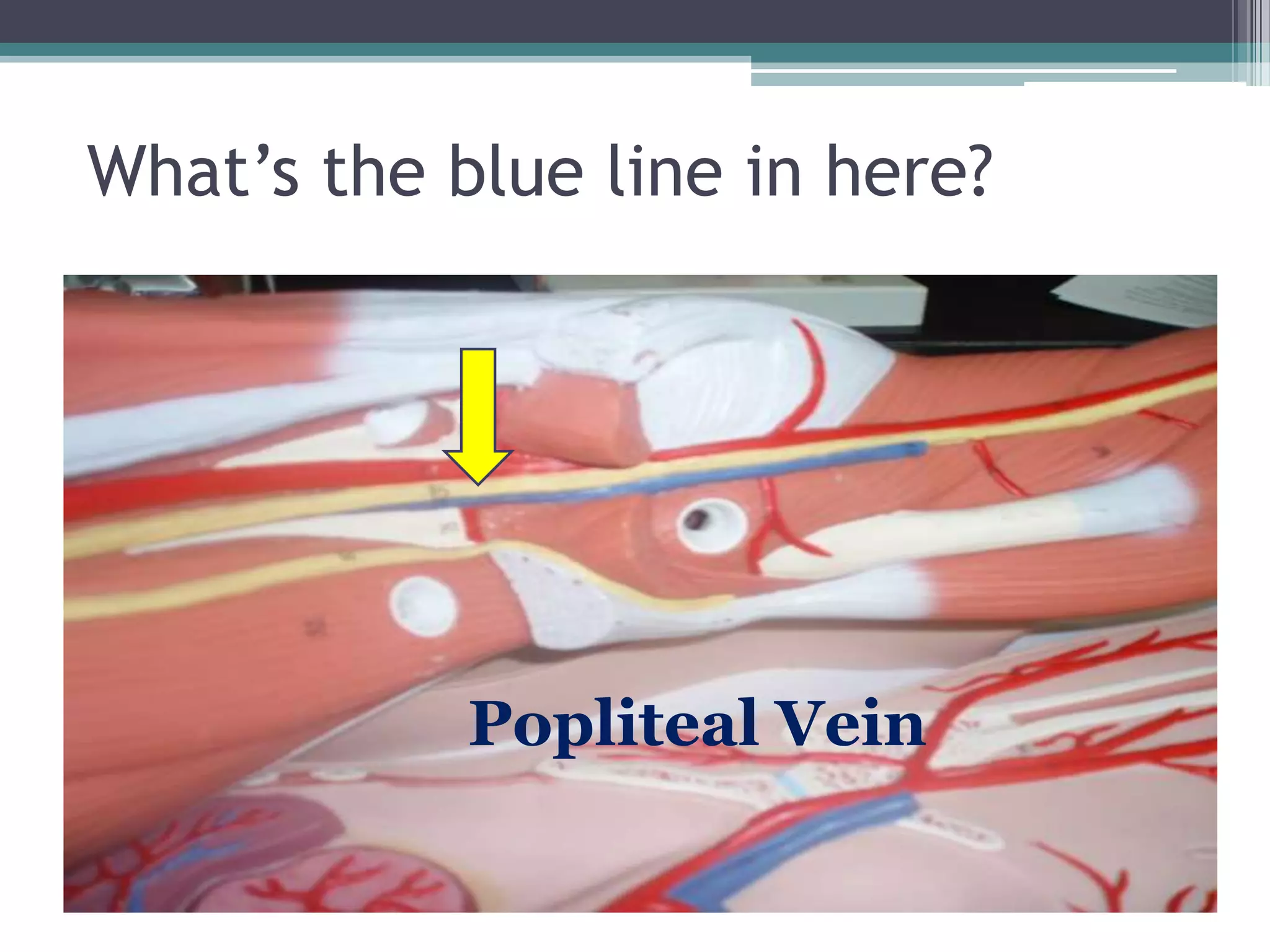 What’s the blue line in here?Popliteal Vein