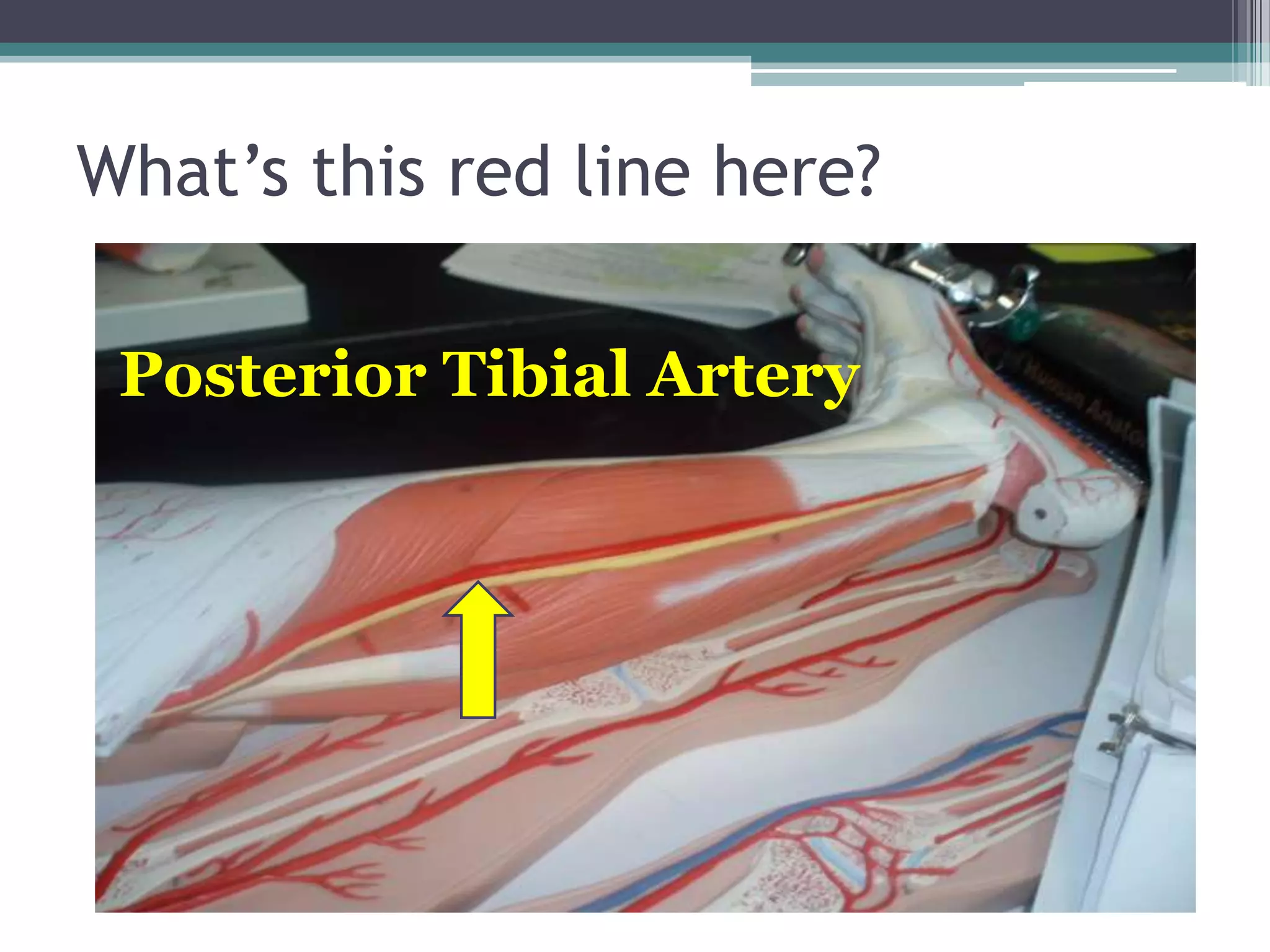 What’s this red line here?Posterior Tibial Artery