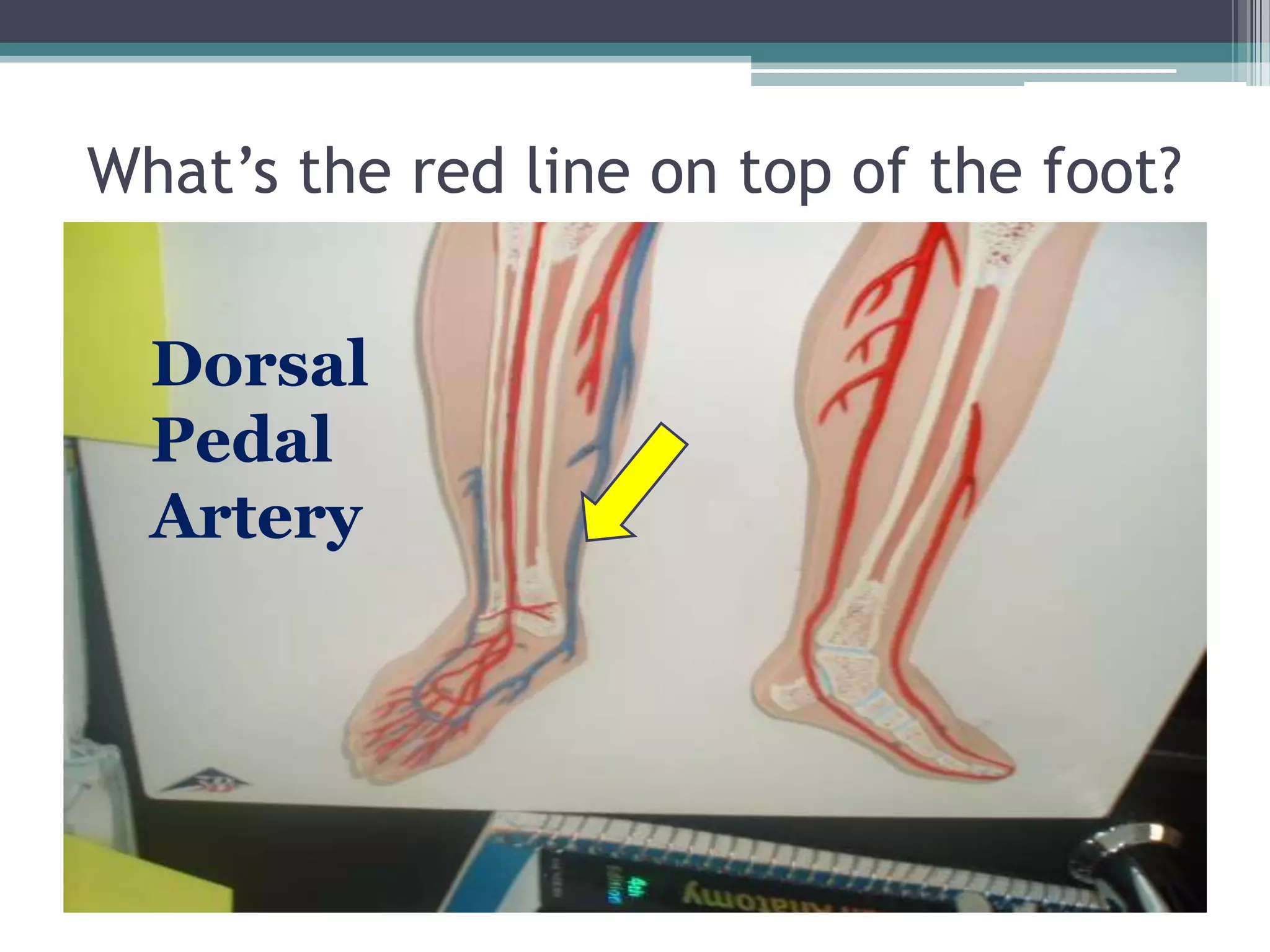 What’s the red line on top of the foot?Dorsal Pedal Artery