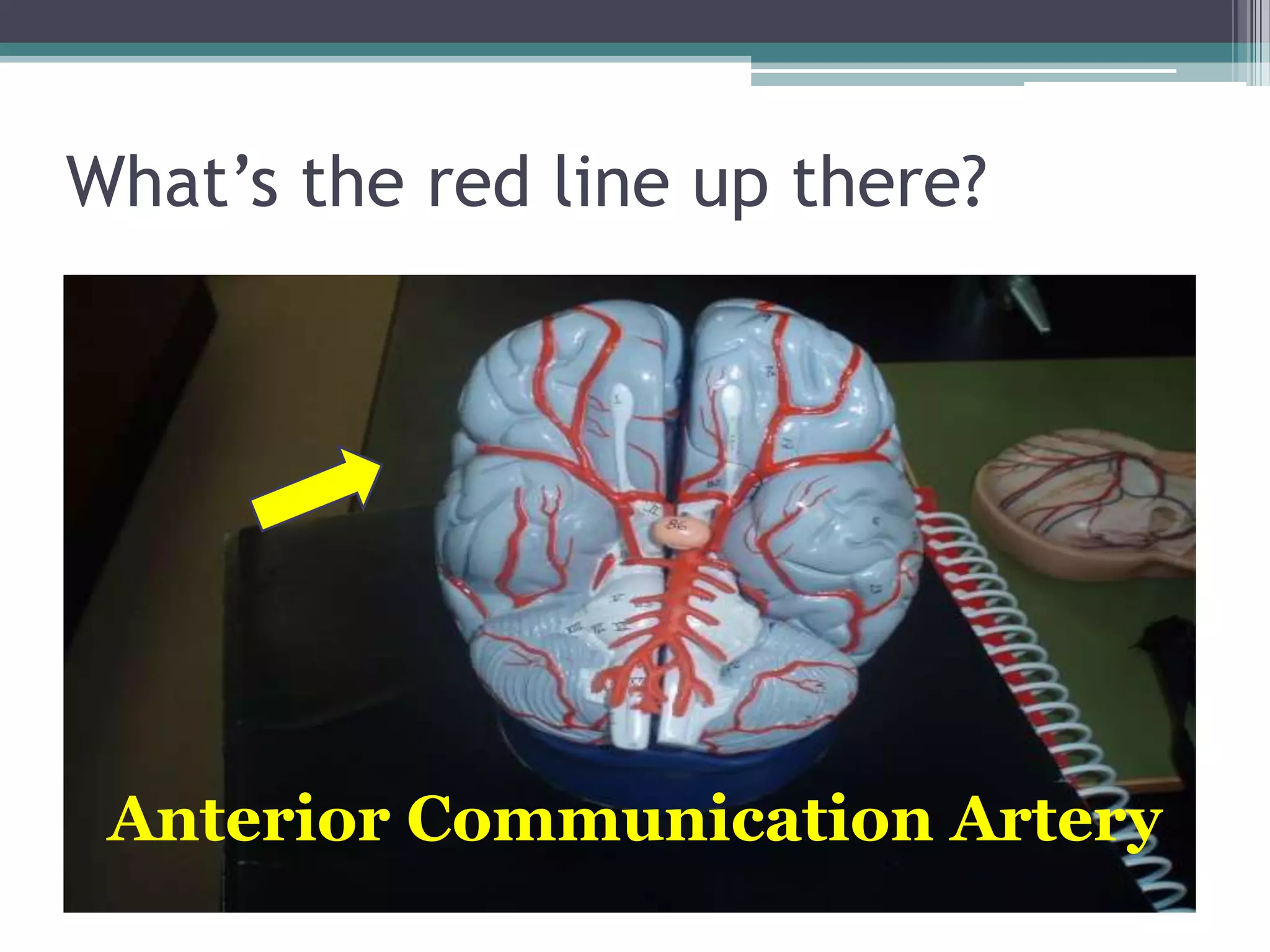 What’s the red line up there?Anterior Communication Artery
