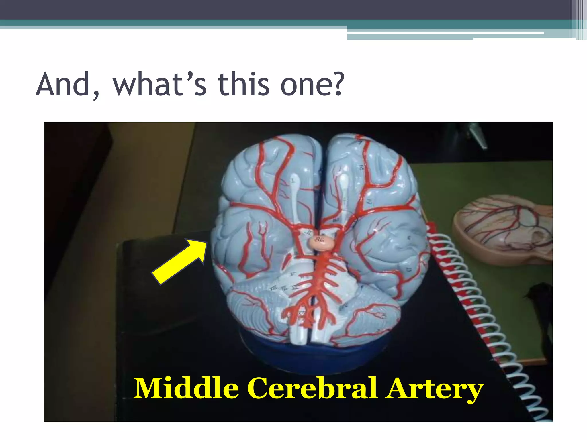 And, what’s this one?Middle Cerebral Artery