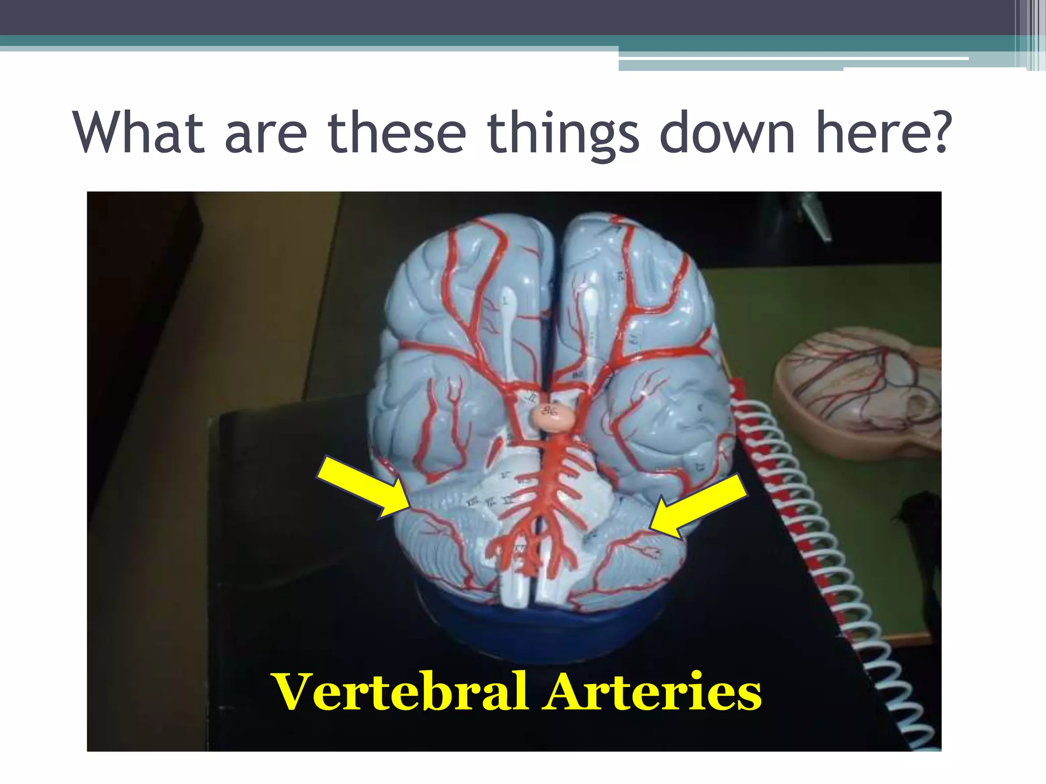 What are these things down here?Vertebral Arteries