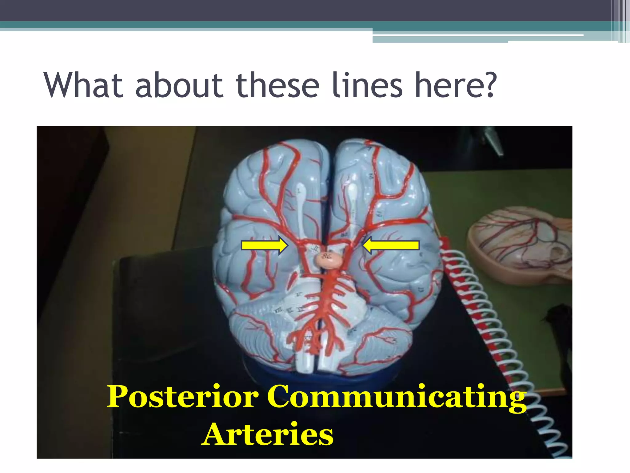 What about these lines here?Posterior Communicating             Arteries