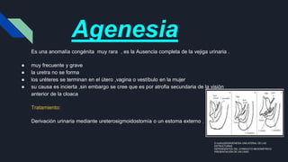 Agenesia
Es una anomalía congénita muy rara , es la Ausencia completa de la vejiga urinaria .
● muy frecuente y grave
● la uretra no se forma
● los uréteres se terminan en el útero ,vagina o vestíbulo en la mujer
● su causa es incierta ,sin embargo se cree que es por atrofia secundaria de la visión
anterior de la cloaca
Tratamiento:
Derivación urinaria mediante ureterosigmoidostomía o un estoma externo .
D.muñoz2003AGENESIA UNILATERAL DE LAS
ESTRUCTURAS
DEPENDIENTES DEL CONDUCTO MESONÉFRICO.
PRESENTACIÓN DE UN CASO
 