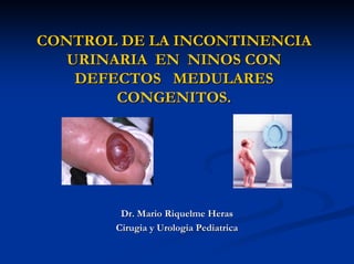 CONTROL DE LA INCONTINENCIA
   URINARIA EN NINOS CON
    DEFECTOS MEDULARES
        CONGENITOS.




        Dr. Mario Riquelme Heras
       Cirugia y Urologia Pediatrica
 