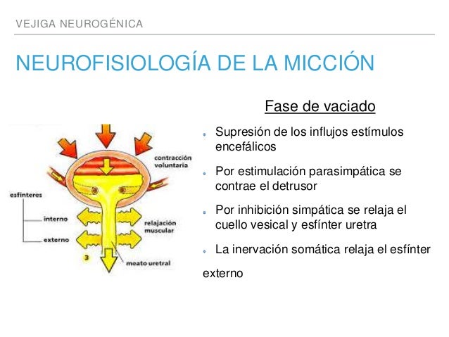 Vejiga neurogenica Vejiga neurogenica