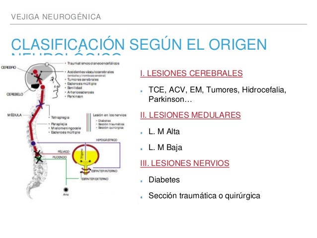 Vejiga neurogenica Vejiga neurogenica