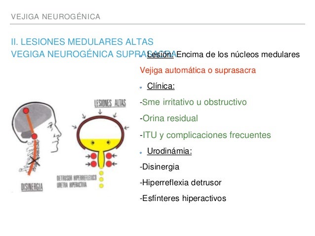Vejiga neurogenica Vejiga neurogenica