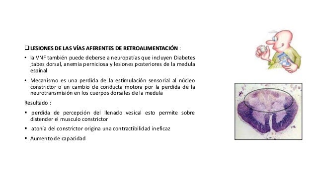 Vejiga neurogenica Vejiga neurogenica