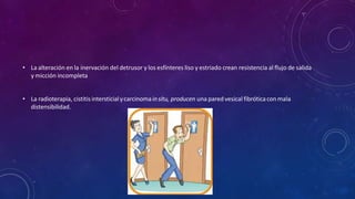 • La alteración en la inervación del detrusor y los esfínteres liso y estriado crean resistencia al flujo de salida
y micción incompleta
• La radioterapia, cistitisintersticialycarcinomainsitu, producen una paredvesical fibróticacon mala
distensibilidad.
 