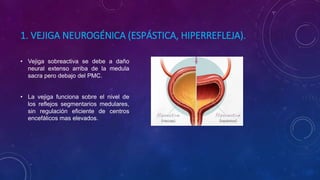 1. VEJIGA NEUROGÉNICA (ESPÁSTICA, HIPERREFLEJA).
• Vejiga sobreactiva se debe a daño
neural extenso arriba de la medula
sacra pero debajo del PMC.
• La vejiga funciona sobre el nivel de
los reflejos segmentarios medulares,
sin regulación eficiente de centros
encefálicos mas elevados.
 