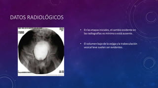 DATOS RADIOLÓGICOS
• Enlasetapasiniciales, elcambio evidenteen
lasradiografías es mínimo oestáausente.
• Elvolumenbajode la vejigayla trabeculación
vesical leve suelen ser evidentes.
 