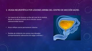 1. VEJIGA NEUROPÁTICA POR LESIONES ARRIBA DEL CENTRO DE MICCIÓN SACRO.
• La mayoría de las lesiones arriba del nivel de la medula
donde se localiza el centro de la micción causan
sobreactividad vesical.
• Arcos reflejos sacros permanecen intactos
• Perdida de inhibición de centros mas elevados
(comportamiento sobreactivo de vejiga y esfínter )
 