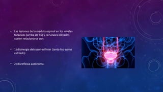 • Las lesiones de la medula espinal en los niveles
torácicos (arriba de T6) y cervicales elevados
suelen relacionarse con:
• 1) disinergia detrusor-esfínter (tanto liso como
estriado)
• 2) disreflexia autónoma.
 