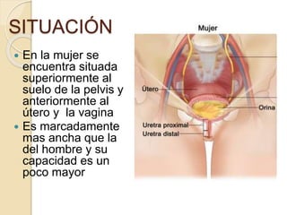 SITUACIÓN
 En la mujer se
encuentra situada
superiormente al
suelo de la pelvis y
anteriormente al
útero y la vagina
 Es marcadamente
mas ancha que la
del hombre y su
capacidad es un
poco mayor
 