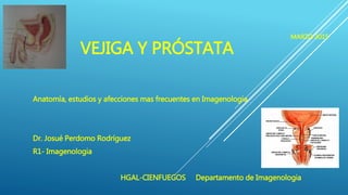 MARZO 2015
VEJIGA Y PRÓSTATA
Anatomía, estudios y afecciones mas frecuentes en Imagenologia
Dr. Josué Perdomo Rodríguez
R1- Imagenologia
HGAL-CIENFUEGOS Departamento de Imagenologia
 
