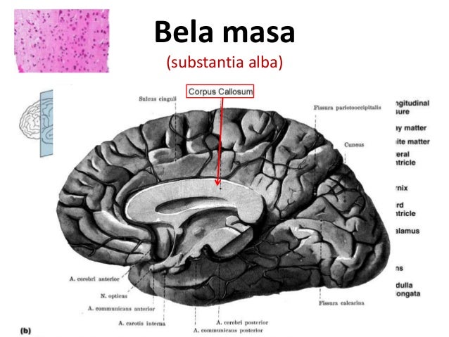 РезÑлÑÐ°Ñ Ñлика за Bela masa hemisfere velikog mozga