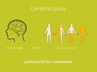 Cerebral palsy
particularly fine movements
brain damage affects body movement
 