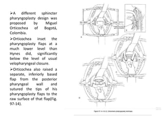 A different sphincter
pharyngoplasty design was
proposed by Miguel
Orticochea of Bogotá,
Colombia.
Orticochea inset the
pharyngoplasty flaps at a
much lower level than
Hynes did, significantly
below the level of usual
velopharyngeal closure.
Orticochea also raised a
separate, inferiorly based
flap from the posterior
pharyngeal wall and
sutured the tips of his
pharyngoplasty flaps to the
raw surface of that flap(Fig.
97-14).
 
