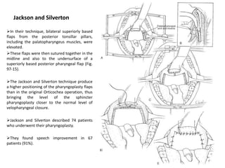 Jackson and Silverton
In their technique, bilateral superiorly based
flaps from the posterior tonsillar pillars,
including the palatopharyngeus muscles, were
elevated.
These flaps were then sutured together in the
midline and also to the undersurface of a
superiorly based posterior pharyngeal flap (Fig.
97-15).
The Jackson and Silverton technique produce
a higher positioning of the pharyngoplasty flaps
than in the original Orticochea operation, thus
bringing the level of the sphincter
pharyngoplasty closer to the normal level of
velopharyngeal closure.
Jackson and Silverton described 74 patients
who underwent their pharyngoplasty.
They found speech improvement in 67
patients (91%).
 