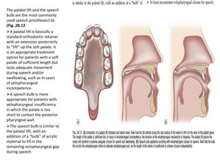 The palatal lift and the speech
bulb are the most commonly
used speech prostheses116
(Fig. 28.13
A palatal lift is basically a
standard orthodontic retainer
with an extension posteriorly
to “lift” up the soft palate. It
is an appropriate treatment
option for patients with a soft
palate of sufficient length but
lacks adequate movement
during speech and/or
swallowing, such as in cases
of velopharyngeal
incompetence.
A speech bulb is more
appropriate for patients with
velopharyngeal insufficiency
in which the palate is too
short to contact the posterior
pharyngeal wall.
The speech bulb is similar to
the palatal lift, with an
addition of a “bulb” of acrylic
material to fill in the
remaining velopharyngeal gap
during speech.
 