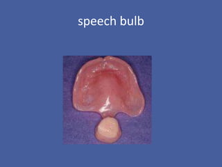 speech bulb
 