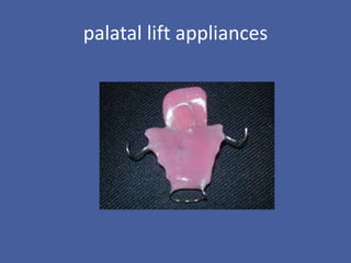 palatal lift appliances
 