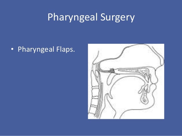 Velopharyngeal insufficiency uvula diagram 