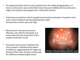 Velopharyngeal insufficiency parag | PPTX