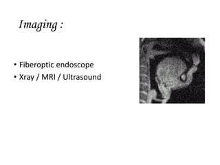 Imaging :
• Fiberoptic endoscope
• Xray / MRI / Ultrasound
 