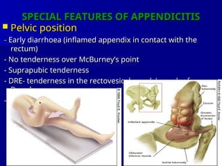 Comprehensive Overview of Vermiform Appendix and Acute Appendicitis ...