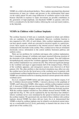 106 Vestibular Evoked Myogenic Potentials
VEMPs in a child with profound deafness. These authors speculated that abnormal
transmission of inner ear volume and pressure to the cerebrospinal ﬂuid space
via the widely patent VA and a large deﬂection of vestibular sensors in the mem-
branous labyrinth in response to stapes movements are possible contributors to
the generation of high-amplitude, low-threshold VEMPs in patients with LVA.
LVA is considered to be the third window, following the oval and round windows,
in the labyrinth.
VEMPs in Children with Cochlear Implants
The cochlear function of both ears is markedly impaired in infants and children
who are candidates for cochlear implantation. However, vestibular function is
also impaired in 10%–20% of such infants. After cochlear implantation, patients
can hear speech sounds, which are converted to electrical signals in a speech pro-
cessor; these signals are transmitted to the internal receiver under the scalp and
conducted to the electrodes in the cochlea. Thus, cochlear nerves that are stimulated
electrically convey information to the central auditory brainstem pathway and
auditory cortex.
There are two problems for vestibular end-organs after cochlear implantation.
One is traumatic damage of vestibular end-organs incurred following insertion of
the electrodes of the cochlear implant into the scala tympani. Tien and Linthicum
histopathologically analyzed the vestibular apparatus from human temporal bones
after cochlear implantation was carried out [10]. They observed signiﬁcant damage
to the vestibular end-organ in approximately half of the temporal bones. Fibrosis
of the vestibular apparatus, and osteogenesis neurons were observed in all their
patients [10]. The other problem is that electrical stimulation may affect not only
the cochlear nerve but also the facial nerve or the vestibular nerve in patients with
a multichannel cochlear implant because of current spread. Based on these ﬁndings
VEMPs are considered useful for evaluating electrical current spread to the inferior
vestibular nerve.
Jin et al. compared VEMPs before and after surgery [11]. Before surgery, 6 of
the 12 children showed normal VEMPs, 1 showed a decrease in the amplitude of
VEMPs, and 5 showed no VEMPs.After surgery, with the cochlear implant switched
off, 11 showed no VEMPs and one showed decreased VEMPs. These results reveal
that even normal VEMPs disappear owing to trauma following electrode insertion.
With the cochlear implant switched on, four children showed normal VEMPs, but
eight did not (Fig. 5). This can be explained by the fact that these four children’s
inferior vestibular nerves were stimulated by the spread of electrical current from
the cochlear implant. We questioned why one-third of these children with cochlear
implants showed VEMPs but others did not. Later, Jin et al. demonstrated that
VEMPs evoked by cochlear implants may be related to an electrical current inten-
sity at a comfortable level (C level), particularly in channels that are closer to the
apical turn of the cochlea [12].
 