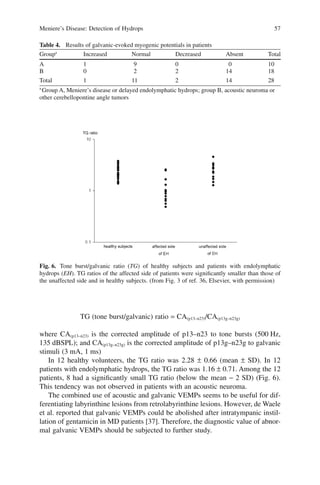 Meniere’s Disease: Detection of Hydrops 57
TG (tone burst/galvanic) ratio = CA(p13–n23)/CA(p13g–n23g)
where CA(p13–n23) is the corrected amplitude of p13–n23 to tone bursts (500 Hz,
135 dBSPL); and CA(p13g–n23g) is the corrected amplitude of p13g–n23g to galvanic
stimuli (3 mA, 1 ms)
In 12 healthy volunteers, the TG ratio was 2.28 ± 0.66 (mean ± SD). In 12
patients with endolymphatic hydrops, the TG ratio was 1.16 ± 0.71. Among the 12
patients, 8 had a signiﬁcantly small TG ratio (below the mean − 2 SD) (Fig. 6).
This tendency was not observed in patients with an acoustic neuroma.
The combined use of acoustic and galvanic VEMPs seems to be useful for dif-
ferentiating labyrinthine lesions from retrolabyrinthine lesions. However, de Waele
et al. reported that galvanic VEMPs could be abolished after intratympanic instil-
lation of gentamicin in MD patients [37]. Therefore, the diagnostic value of abnor-
mal galvanic VEMPs should be subjected to further study.
Fig. 6. Tone burst/galvanic ratio (TG) of healthy subjects and patients with endolymphatic
hydrops (EH). TG ratios of the affected side of patients were signiﬁcantly smaller than those of
the unaffected side and in healthy subjects. (from Fig. 3 of ref. 36, Elsevier, with permission)
Table 4. Results of galvanic-evoked myogenic potentials in patients
Groupa
Increased Normal Decreased Absent Total
A 1 9 0 0 10
B 0 2 2 14 18
Total 1 11 2 14 28
a
Group A, Meniere’s disease or delayed endolymphatic hydrops; group B, acoustic neuroma or
other cerebellopontine angle tumors
 