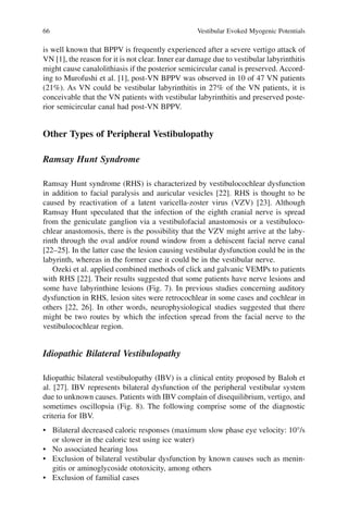 66 Vestibular Evoked Myogenic Potentials
is well known that BPPV is frequently experienced after a severe vertigo attack of
VN [1], the reason for it is not clear. Inner ear damage due to vestibular labyrinthitis
might cause canalolithiasis if the posterior semicircular canal is preserved. Accord-
ing to Murofushi et al. [1], post-VN BPPV was observed in 10 of 47 VN patients
(21%). As VN could be vestibular labyrinthitis in 27% of the VN patients, it is
conceivable that the VN patients with vestibular labyrinthitis and preserved poste-
rior semicircular canal had post-VN BPPV.
Other Types of Peripheral Vestibulopathy
Ramsay Hunt Syndrome
Ramsay Hunt syndrome (RHS) is characterized by vestibulocochlear dysfunction
in addition to facial paralysis and auricular vesicles [22]. RHS is thought to be
caused by reactivation of a latent varicella-zoster virus (VZV) [23]. Although
Ramsay Hunt speculated that the infection of the eighth cranial nerve is spread
from the geniculate ganglion via a vestibulofacial anastomosis or a vestibuloco-
chlear anastomosis, there is the possibility that the VZV might arrive at the laby-
rinth through the oval and/or round window from a dehiscent facial nerve canal
[22–25]. In the latter case the lesion causing vestibular dysfunction could be in the
labyrinth, whereas in the former case it could be in the vestibular nerve.
Ozeki et al. applied combined methods of click and galvanic VEMPs to patients
with RHS [22]. Their results suggested that some patients have nerve lesions and
some have labyrinthine lesions (Fig. 7). In previous studies concerning auditory
dysfunction in RHS, lesion sites were retrocochlear in some cases and cochlear in
others [22, 26]. In other words, neurophysiological studies suggested that there
might be two routes by which the infection spread from the facial nerve to the
vestibulocochlear region.
Idiopathic Bilateral Vestibulopathy
Idiopathic bilateral vestibulopathy (IBV) is a clinical entity proposed by Baloh et
al. [27]. IBV represents bilateral dysfunction of the peripheral vestibular system
due to unknown causes. Patients with IBV complain of disequilibrium, vertigo, and
sometimes oscillopsia (Fig. 8). The following comprise some of the diagnostic
criteria for IBV.
• Bilateral decreased caloric responses (maximum slow phase eye velocity: 10°/s
or slower in the caloric test using ice water)
• No associated hearing loss
• Exclusion of bilateral vestibular dysfunction by known causes such as menin-
gitis or aminoglycoside ototoxicity, among others
• Exclusion of familial cases
 