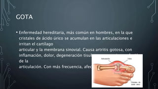 GOTA
• Enfermedad hereditaria, más común en hombres, en la que
cristales de ácido úrico se acumulan en las articulaciones e
irritan el cartílago
articular y la membrana sinovial. Causa artritis gotosa, con
inflamación, dolor, degeneración tisular y, en ocasiones, fusión
de la
articulación. Con más frecuencia, afecta al dedo gordo
 