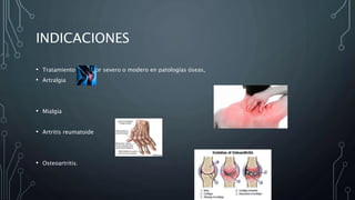 INDICACIONES
• Tratamiento del dolor severo o modero en patologías óseas,
• Artralgia
• Mialgia
• Artritis reumatoide
• Osteoartritis.
 