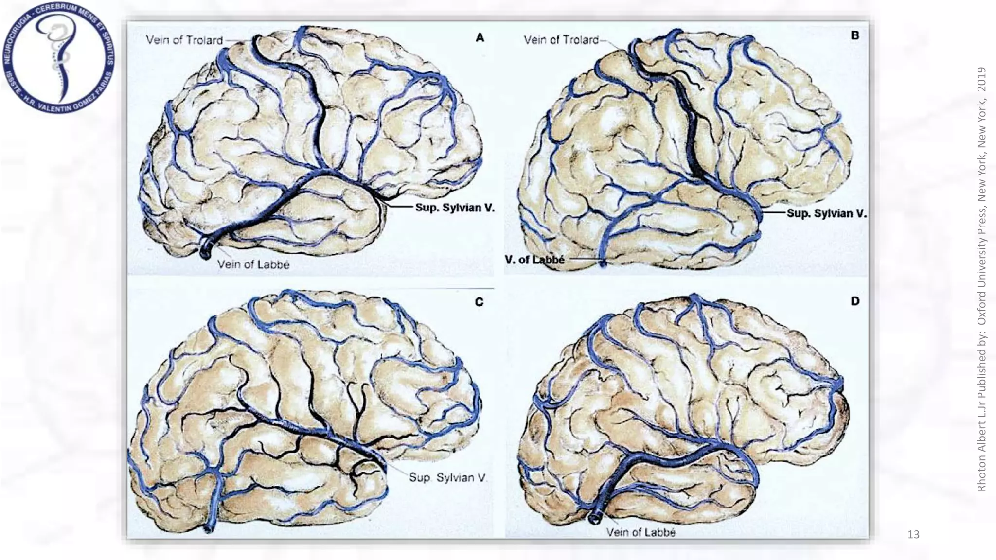 VENAS CEREBRALES rhoton .pptx
