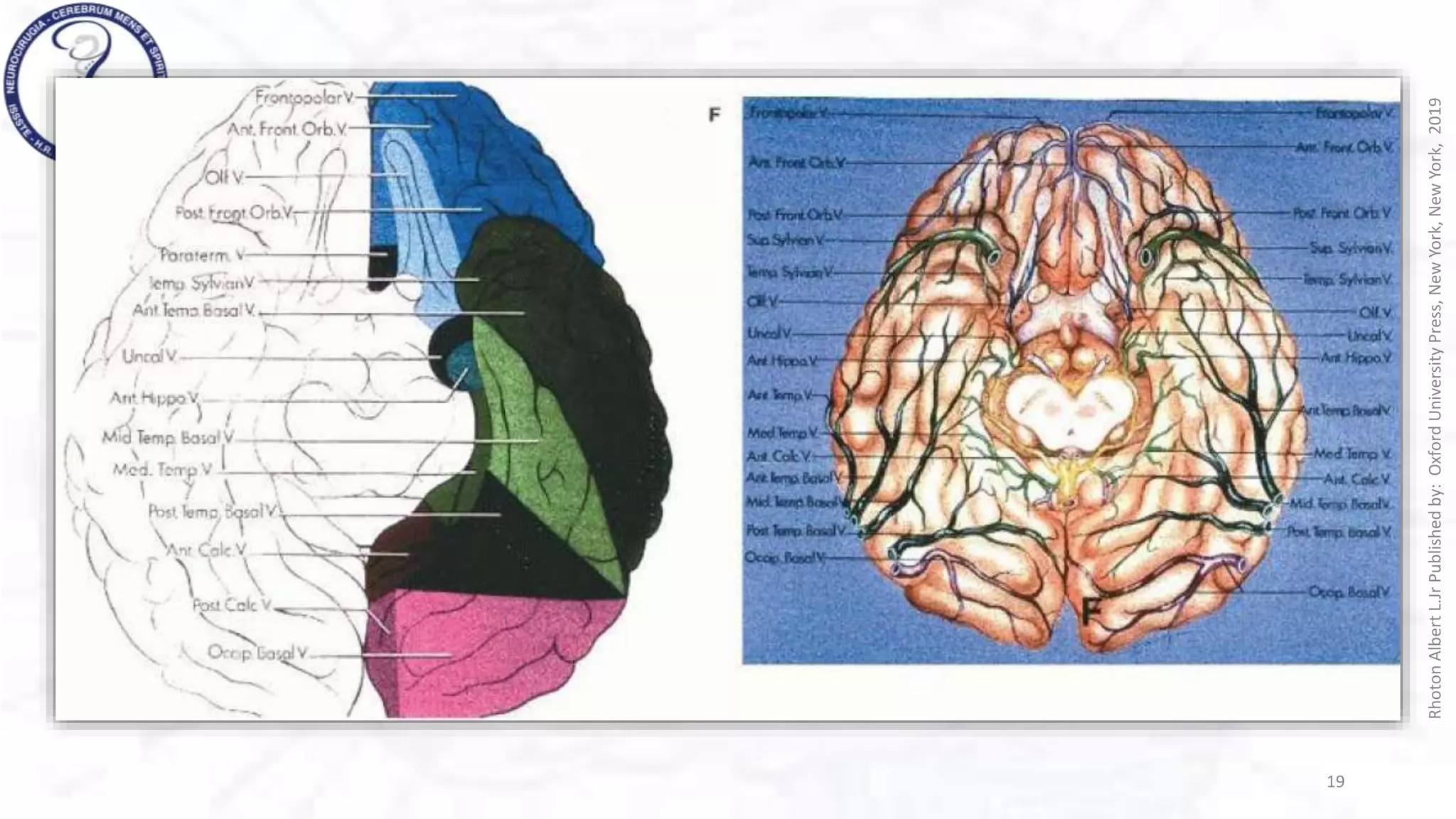 VENAS CEREBRALES rhoton .pptx