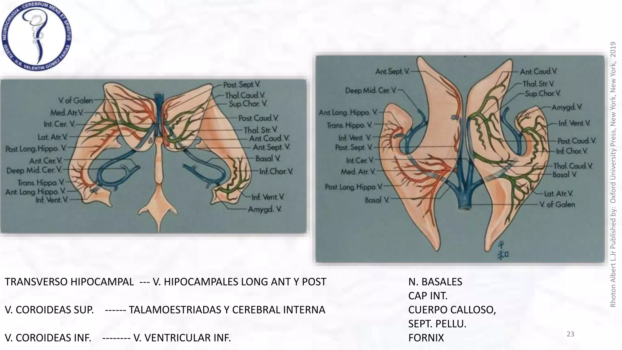 VENAS CEREBRALES rhoton .pptx