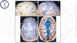 VENAS CEREBRALES rhoton .pptx