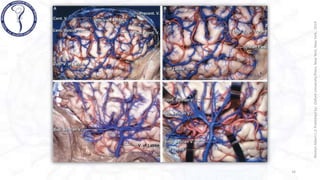 VENAS CEREBRALES rhoton .pptx