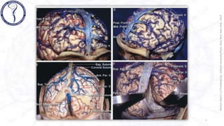 VENAS CEREBRALES rhoton .pptx