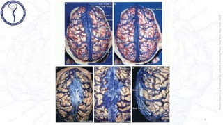 VENAS CEREBRALES rhoton .pptx