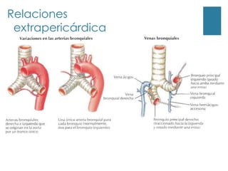 Relaciones
 extrapericárdica
 