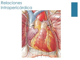 Relaciones
Intrapericárdica
 
